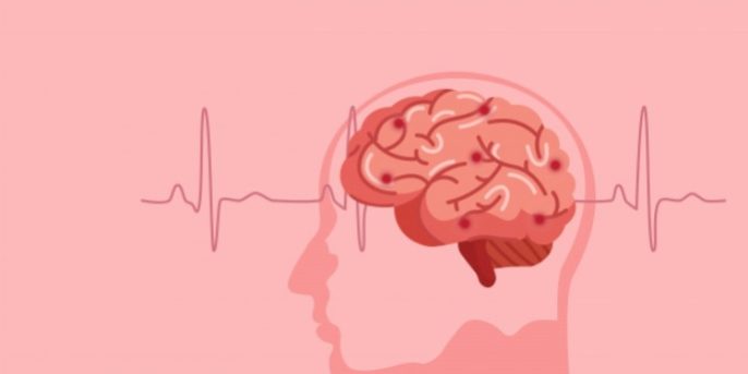 what is stroke